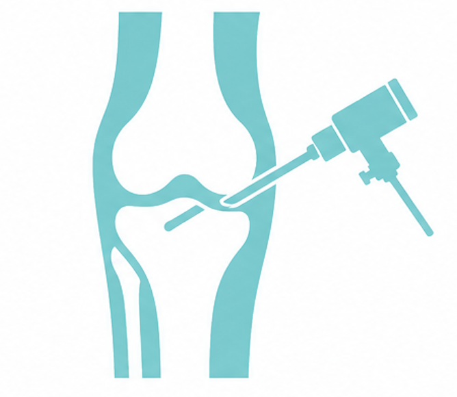 arthroscopy knee ankle