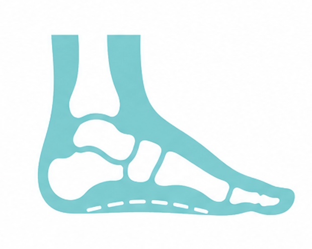 flatfoot correction